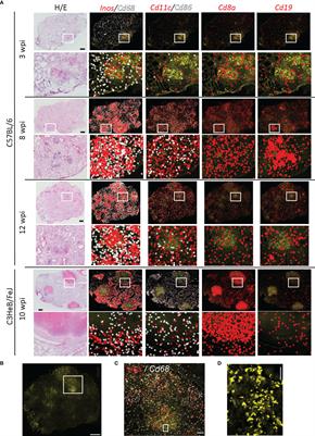 Spatial Resolution of Mycobacterium tuberculosis Bacteria and Their Surrounding Immune Environments Based on Selected Key Transcripts in Mouse Lungs